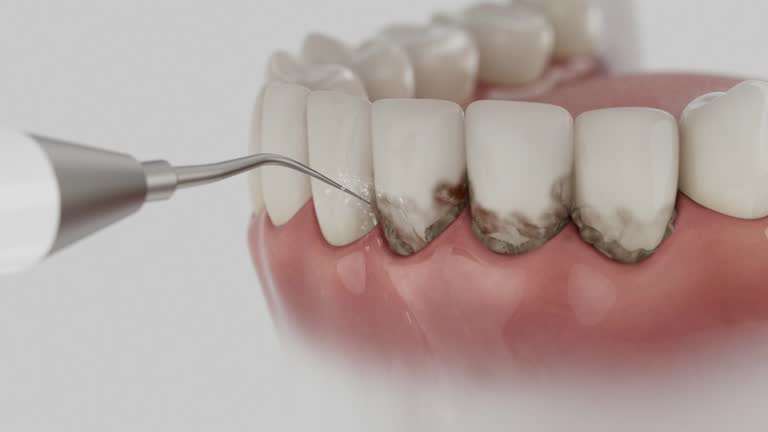 Reliable Root Canal Treatment contractor in Clay County County, NC by Dentist Open Now